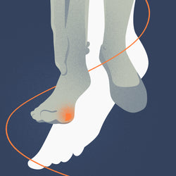 Bunions