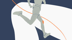 Runner's Knee (Chondromalacia)
