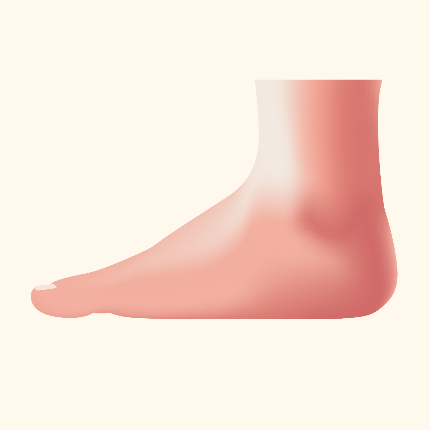 Flat Feet
